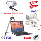 Rcs-400 Carejoy Sony Video Camera Electronic Colposcope Tripod Cd 190891735126